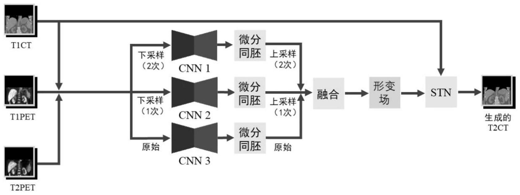 一种基于深度学习算法的延迟CT图像生成方法